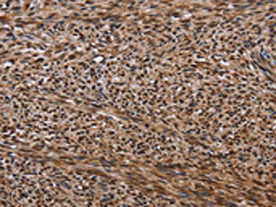 KIF1C Antibody