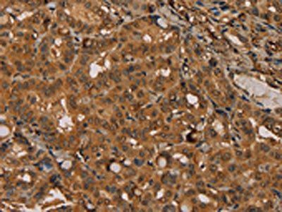 KIF20A Antibody