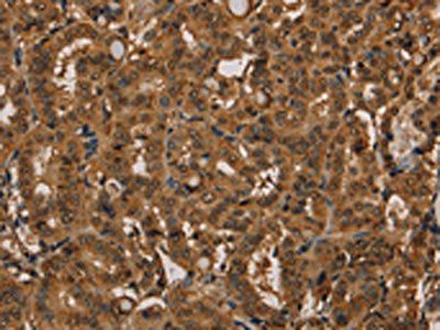 KIF20A Antibody