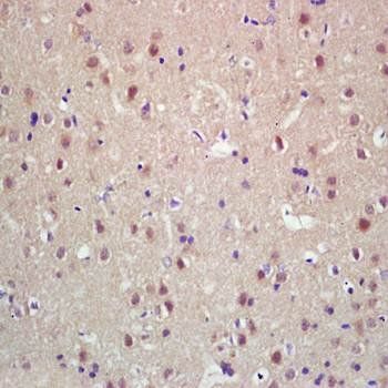 KIF20A Rabbit Polyclonal Antibody