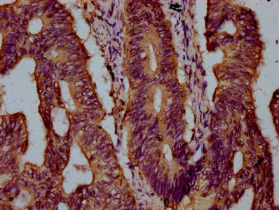 KIF21B Antibody