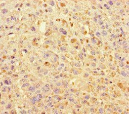 KIF24 Antibody