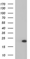 KIF25 Antibody
