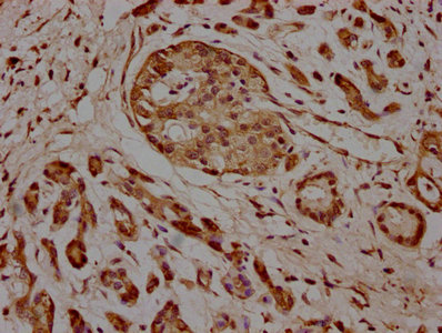 KIF25 Antibody