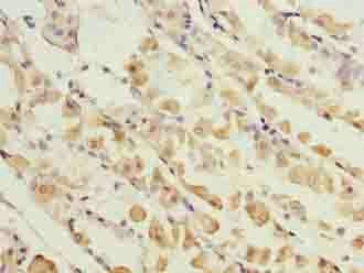 KIF26B Antibody