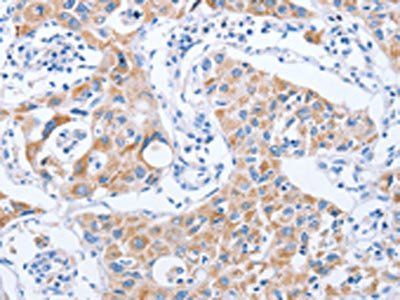 KIF3A Antibody