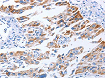 KIF3A Antibody