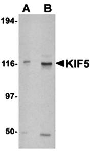KIF5 Antibody
