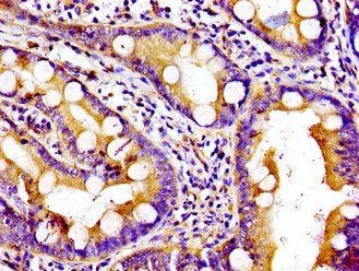 KIF5B Antibody