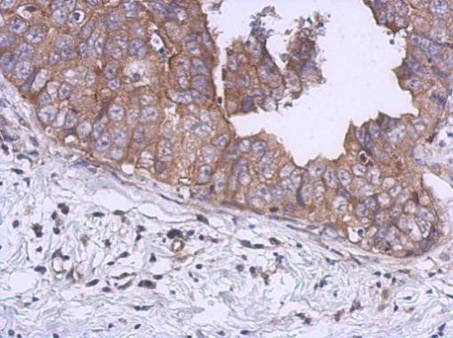 KIF5B antibody [C3], C-term