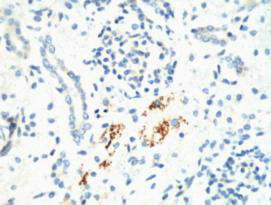 KIF7 Monoclonal Antibody