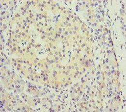 KIFC3 Antibody