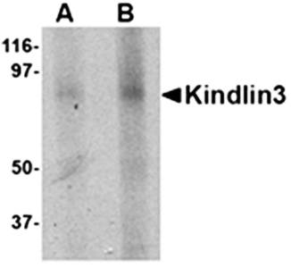 KINDLIN3 Antibody