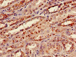 KNG1 Antibody, Biotin conjugated
