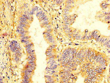 KIR2DL1 antibody