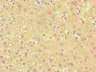 KIR2DL3 Antibody