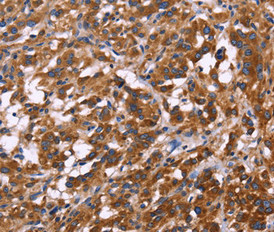 KIR2DL3 antibody