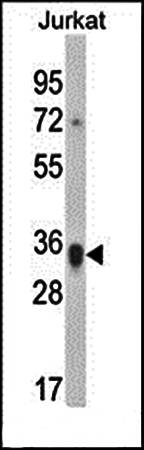 KIR2DS1 antibody