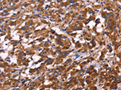 KIR2DL3/KIR2DL1/KIR2DL4/KIR2DS4 Antibody