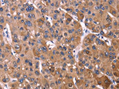 KIR2DL3/KIR2DL1/KIR2DL4/KIR2DS4 Antibody