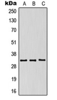 KIR2DS5 antibody