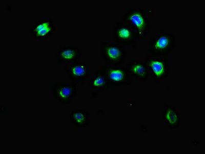 KIR3DL2 Antibody