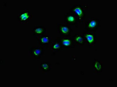 KIR3DL2 antibody