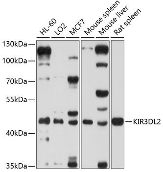 KIR3DL2 antibody