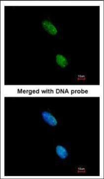 KIR3DL2 antibody