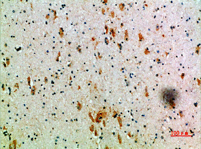 KIR3DL2 antibody