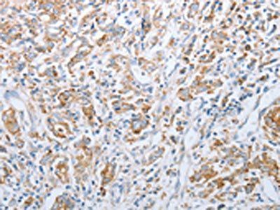KISS1R Antibody