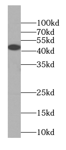 KISS1R-Specific antibody