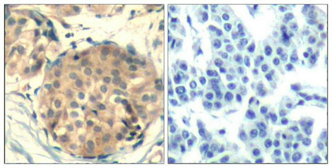 KIT (Ab-936) Antibody