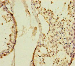 KIZ Antibody