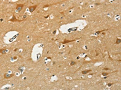KLC1 Antibody