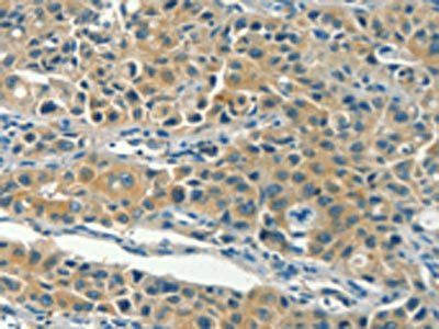 KLC1 Antibody