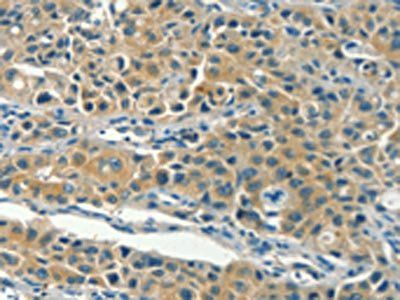 KLC1 antibody