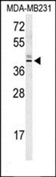 KLDC2 antibody