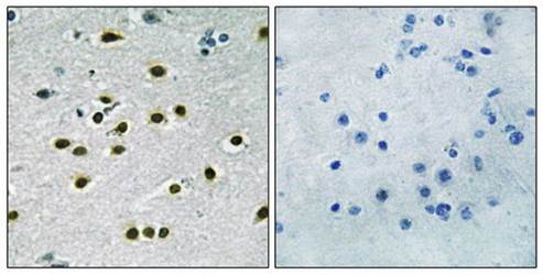 KLF10/11 antibody