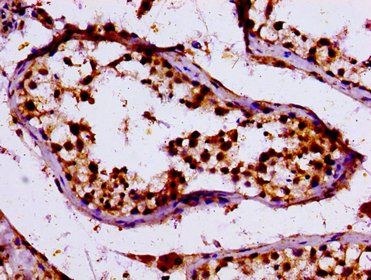 KLF11 Antibody