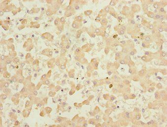 KLF15 Antibody