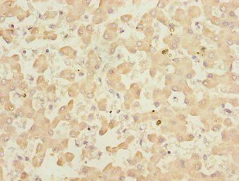 KLF15 antibody