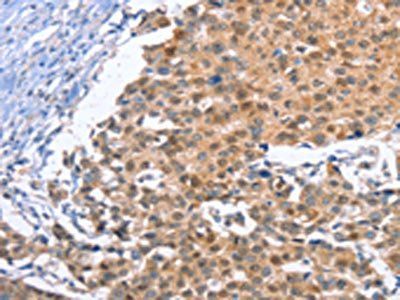 KLF15 Antibody