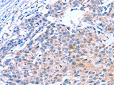 KLF15 Antibody