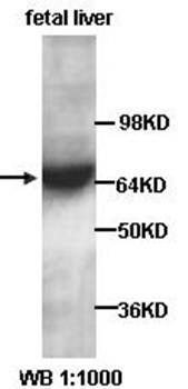 KLF15 Rabbit Polyclonal Antibody