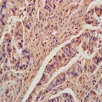 KLF2 Rabbit Polyclonal Antibody