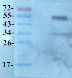 KLF2 Rabbit Polyclonal Antibody
