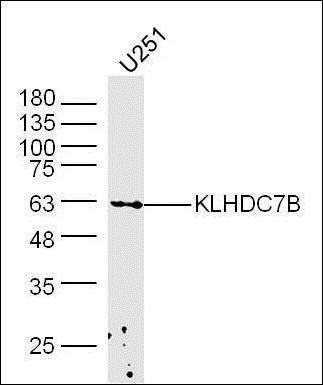 KLHDC7B antibody