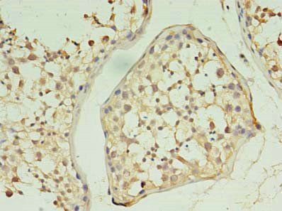 KLHL12 antibody