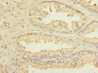 KLHL13 Antibody
